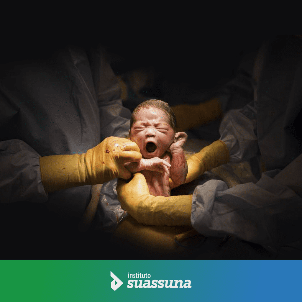 O parto ideal existe?